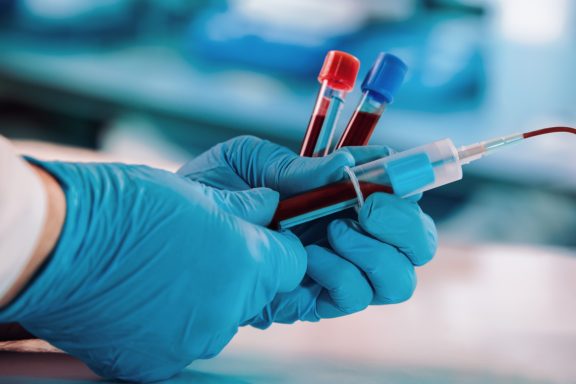 Labordiagnostik